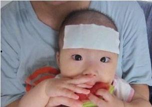 发烧后可以吃瓜吗,西瓜食用需谨慎