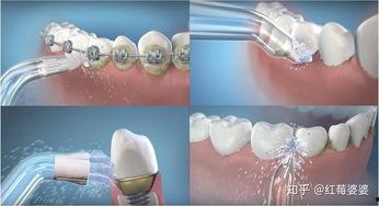 戴牙冠可以吃瓜吗,能否畅享夏日瓜果？